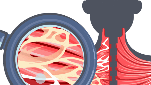 What Is Fascia And How to Keep It Healthy